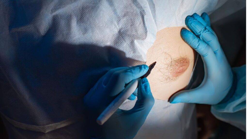 Brustvergrößerung mit Implantaten: So finden Sie die richtige Klinik in NRW